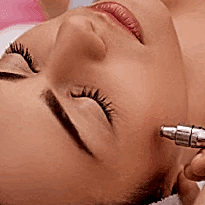 Kayseri İğneli Lazer Epilasyon