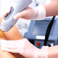 Kayseri Lazer Epilasyon