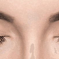 Kayseri Kirpik Lifting